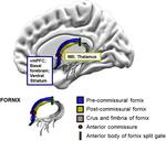 Connecting the past and future: the role of the pre-commissural fornix in episodic autobiographical memory and simulation